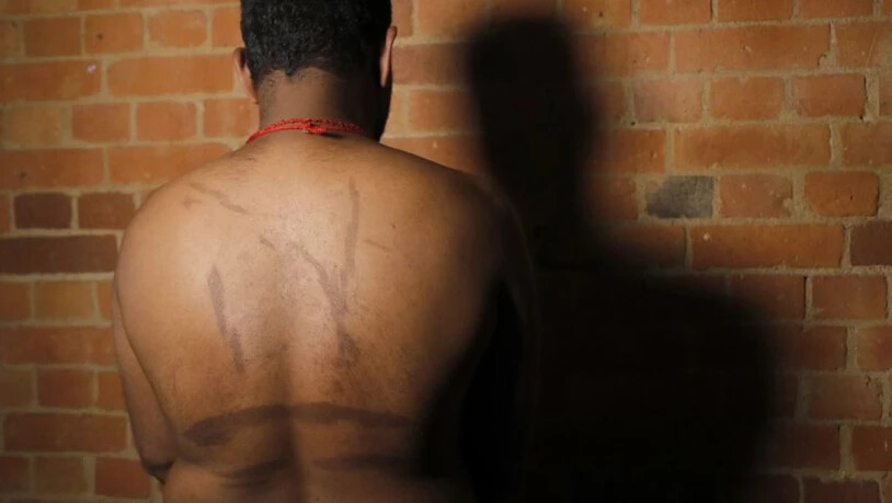Ein politischer Flüchtling aus Sri Lanka zeigt Mitte 2017 während eines Interviews in London seine Folterspuren. Er und weitere rund 50 Tamilen gaben an, von den Sicherheitskräften des jetzigen Regimes entführt, vergewaltigt und gefoltert worden zu sein…