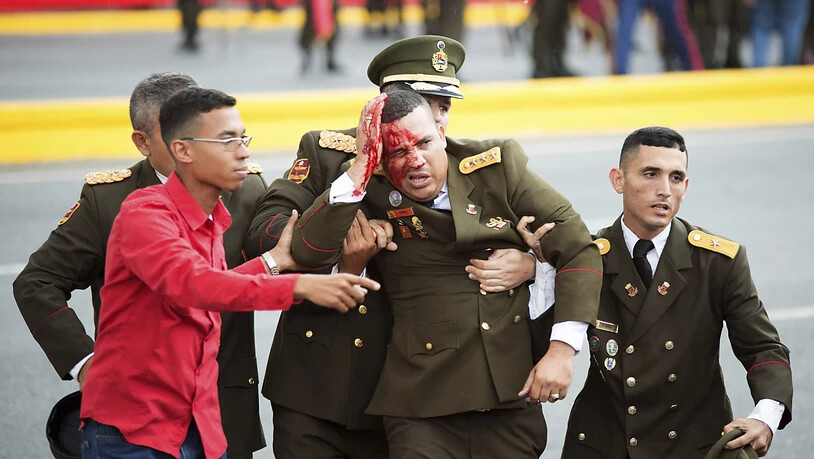 Verletzter venezolanischer Armee-Angehöriger nach dem angeblichen Anschlagsversuch auf Präsident Maduro in Caracas.
