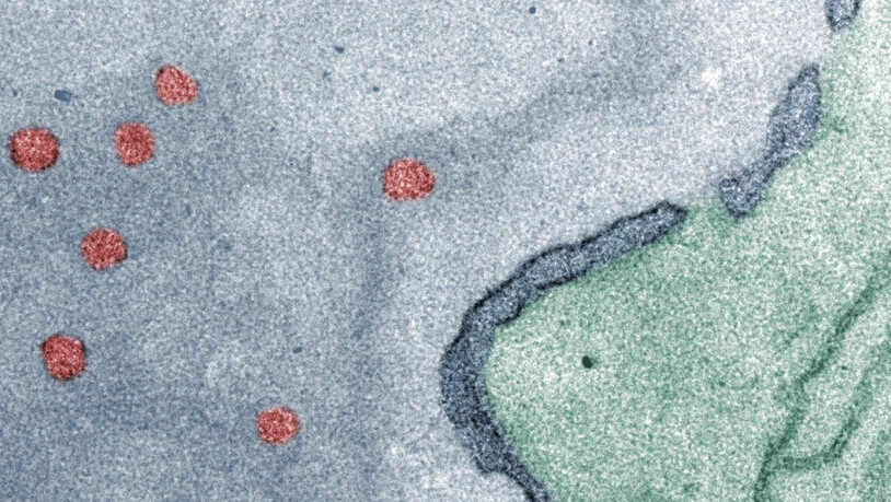 Sieht fast aus wie moderne Kunst: Die roten Punkte sind die neuartigen Nanocontainer im Zellkern (grau). Diese winzigen Behälter haben die nötige Beschaffenheit und den "Zugangscode", um ihre Fracht in den Zellkern zu bringen.