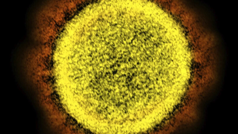Eine Aufnahme mit dem Elektronenmikroskop des Coronavirus.